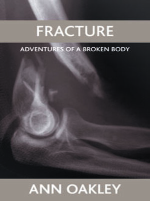 cover image of Fracture